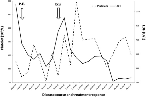 Disease course and treatment response. The timeline from presentation detailing platelet and lactate dehydrogenase (LDH) response to plasma exchange and eculizumab (Ecu).